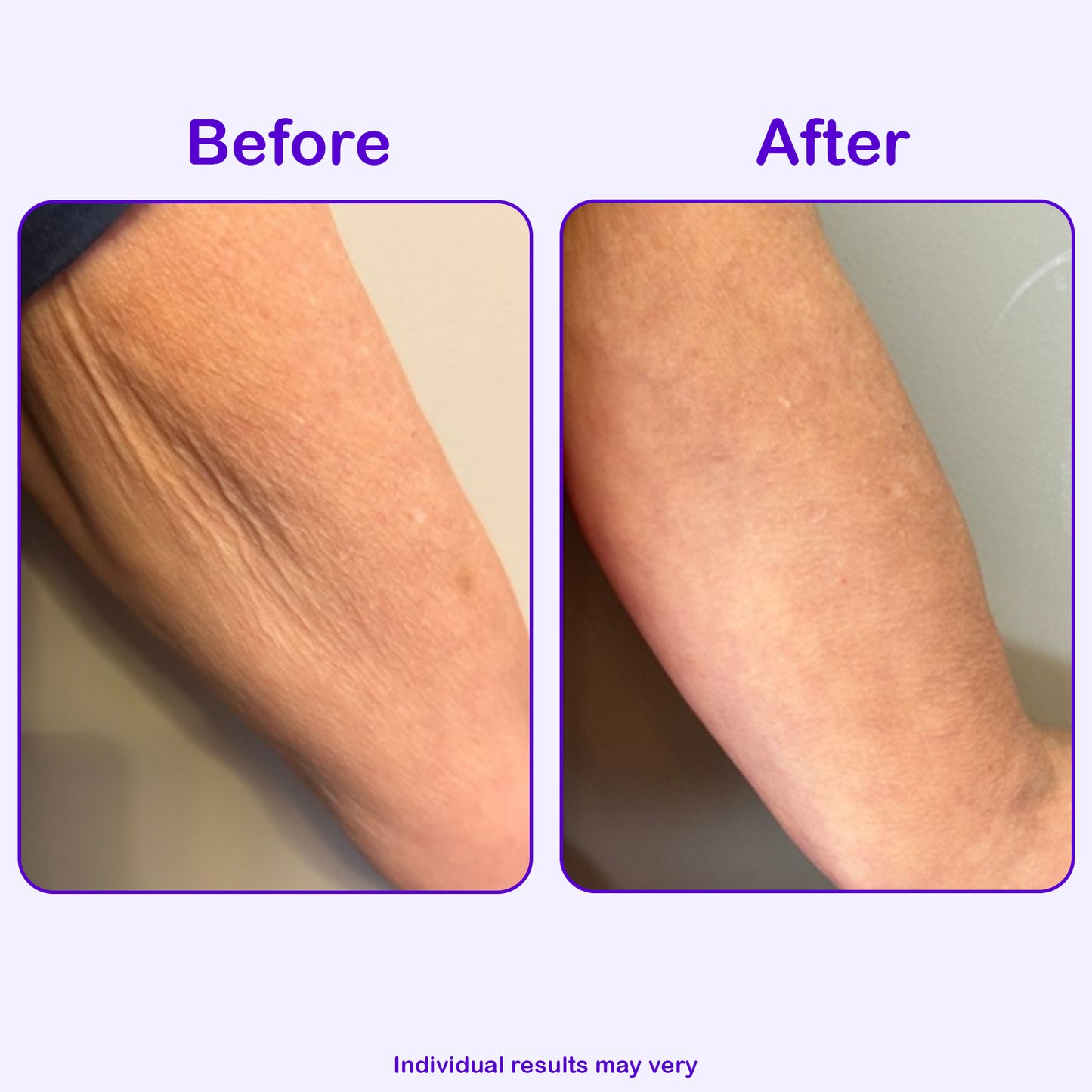 Sculpt & Tone Arm Cream