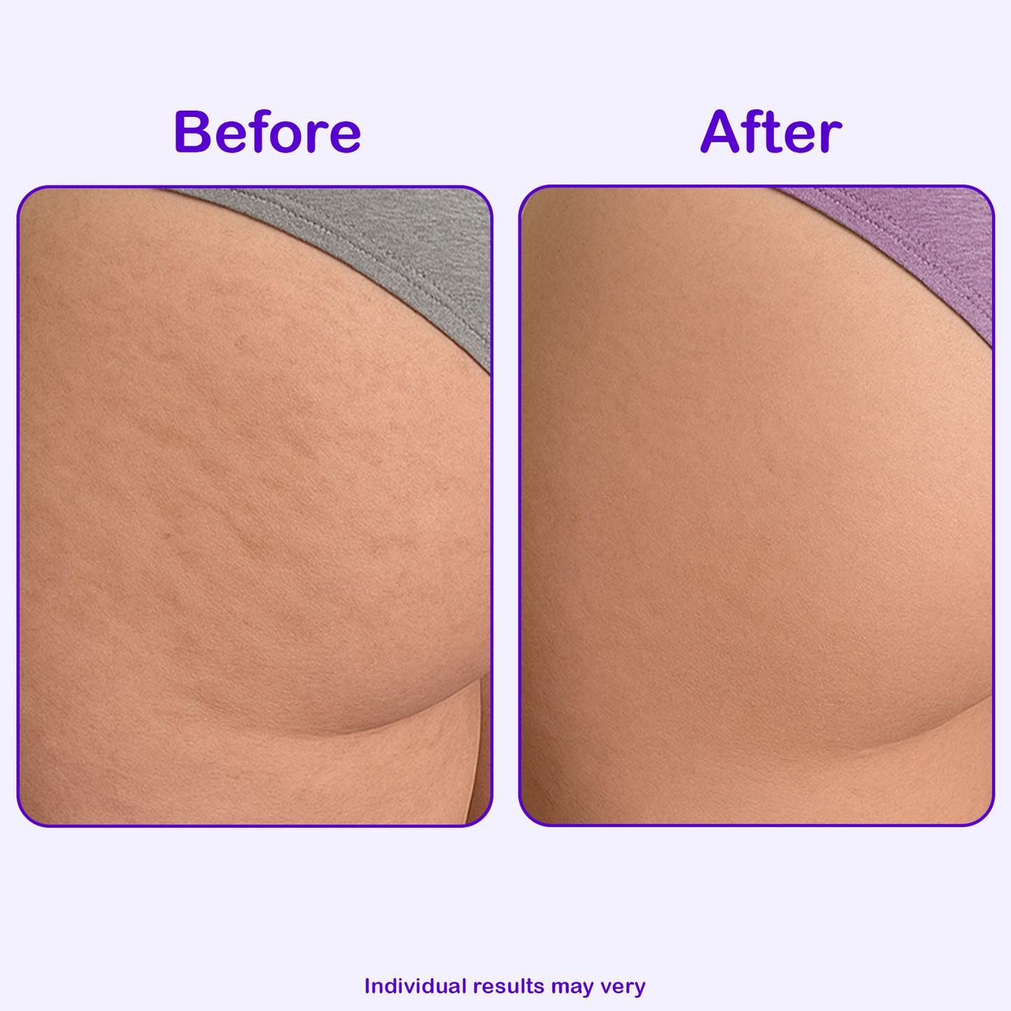 Firming Butt & Thigh Cream